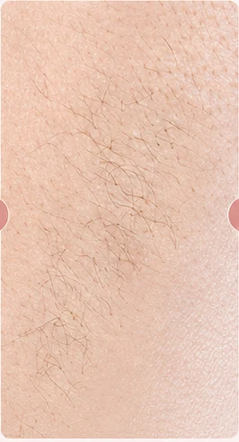 Sau 4 tuần sử dụng MLay T25C